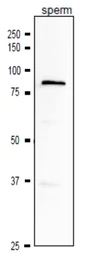 Anti-ACE3 antibody used in Western Blot (WB). GTX00904