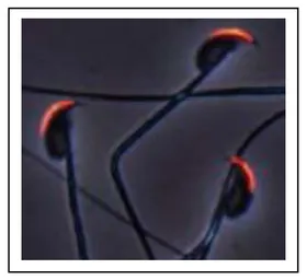Anti-ACE3 antibody used in Immunocytochemistry/ Immunofluorescence (ICC/IF). GTX00904