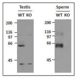 Anti-SLC22A14 antibody used in Western Blot (WB). GTX00905