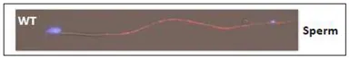 Anti-SLC22A14 antibody used in Immunocytochemistry/ Immunofluorescence (ICC/IF). GTX00905