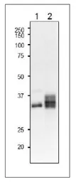 Anti-Leaf FNR antibody used in Western Blot (WB). GTX00908