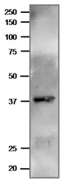 Anti-Plasmodium falciparum FNR antibody used in Western Blot (WB). GTX00910