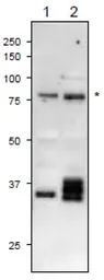 Anti-Plasmodium falciparum FNR antibody used in Western Blot (WB). GTX00910