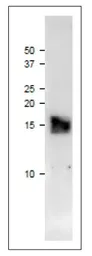 Anti-Ferredoxin 3 antibody used in Western Blot (WB). GTX00912