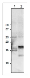 Anti-Ferredoxin 3 antibody used in Western Blot (WB). GTX00912
