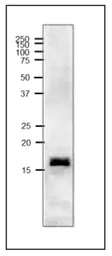 Anti-Ferredoxin 2 antibody used in Western Blot (WB). GTX00914