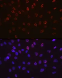 Anti-Aurora B antibody [GT1146] used in Immunocytochemistry/ Immunofluorescence (ICC/IF). GTX00916