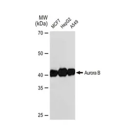 Anti-Aurora B antibody [GT1146] used in Western Blot (WB). GTX00916