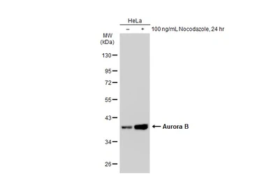 Anti-Aurora B antibody [GT1146] used in Western Blot (WB). GTX00916