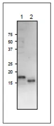 Anti-Ferredoxin 3 antibody used in Western Blot (WB). GTX00918