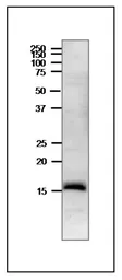 Anti-Ferredoxin 3 antibody used in Western Blot (WB). GTX00918