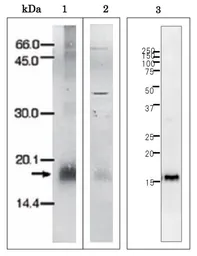 Anti-Plasmodium falciparum Ferredoxin antibody used in Western Blot (WB). GTX00920