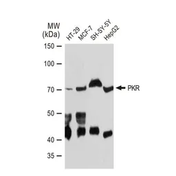 Anti-PKR antibody [GT1150] used in Western Blot (WB). GTX00929