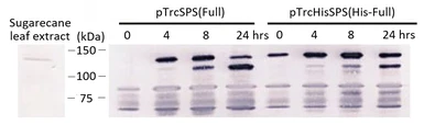 Anti-Sucrose-Phosphate Synthase antibody used in Western Blot (WB). GTX00931
