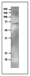 Anti-TGG2 / Myrosinase 2 antibody used in Western Blot (WB). GTX00933