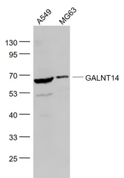 Anti-GALNT14 antibody used in Western Blot (WB). GTX00937