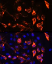 Anti-Vimentin antibody [GT1180] used in Immunocytochemistry/ Immunofluorescence (ICC/IF). GTX00942