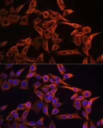 Anti-Vimentin antibody [GT1180] used in Immunocytochemistry/ Immunofluorescence (ICC/IF). GTX00942