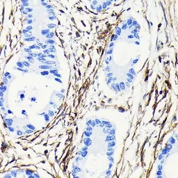 Anti-Vimentin antibody [GT1180] used in IHC (Paraffin sections) (IHC-P). GTX00942