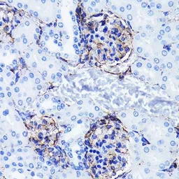 Anti-Vimentin antibody [GT1180] used in IHC (Paraffin sections) (IHC-P). GTX00942
