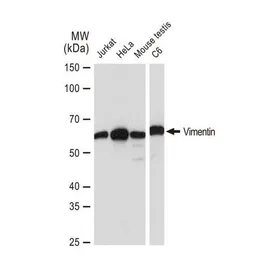 Anti-Vimentin antibody [GT1180] used in Western Blot (WB). GTX00942