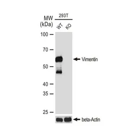 Anti-Vimentin antibody [GT1180] used in Western Blot (WB). GTX00942