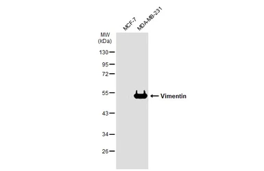 Anti-Vimentin antibody [GT1180] used in Western Blot (WB). GTX00942