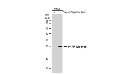 Anti-PARP (cleaved) antibody [GT1181] used in Western Blot (WB). GTX00943
