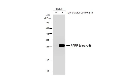 Anti-PARP (cleaved) antibody [GT1181] used in Western Blot (WB). GTX00943