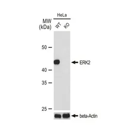 Anti-ERK2 antibody [GT1183] used in Western Blot (WB). GTX00945