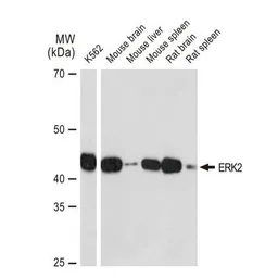 Anti-ERK2 antibody [GT1183] used in Western Blot (WB). GTX00945