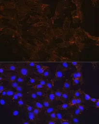 Anti-beta Catenin antibody [GT1186] used in Immunocytochemistry/ Immunofluorescence (ICC/IF). GTX00948