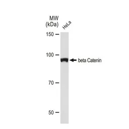 Anti-beta Catenin antibody [GT1186] used in Western Blot (WB). GTX00948