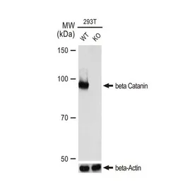 Anti-beta Catenin antibody [GT1186] used in Western Blot (WB). GTX00948
