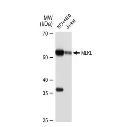 Anti-MLKL antibody [GT1191] used in Western Blot (WB). GTX00953