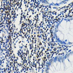 Anti-PIM1 antibody [GT1192] used in IHC (Paraffin sections) (IHC-P). GTX00954
