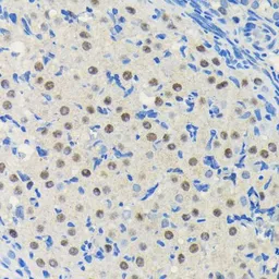 Anti-PIM1 antibody [GT1192] used in IHC (Paraffin sections) (IHC-P). GTX00954