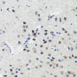 Anti-PIM1 antibody [GT1192] used in IHC (Paraffin sections) (IHC-P). GTX00954
