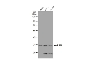 Anti-PIM1 antibody [GT1192] used in Western Blot (WB). GTX00954