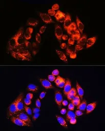 Anti-SQSTM1 / P62 antibody [GT1193] used in Immunocytochemistry/ Immunofluorescence (ICC/IF). GTX00955