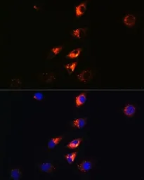 Anti-SQSTM1 / P62 antibody [GT1193] used in Immunocytochemistry/ Immunofluorescence (ICC/IF). GTX00955