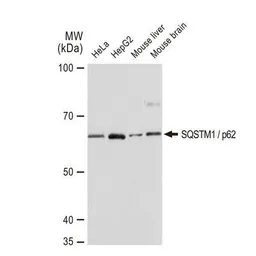 Anti-SQSTM1 / P62 antibody [GT1193] used in Western Blot (WB). GTX00955