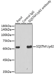Anti-SQSTM1 / P62 antibody [GT1193] used in Immunoprecipitation (IP). GTX00955