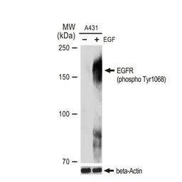 Anti-EGFR (phospho Tyr1068) antibody [GT1196] used in Western Blot (WB). GTX00958