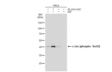 Anti-c-Jun (phospho Ser63) antibody [GT1198] used in Western Blot (WB). GTX00960