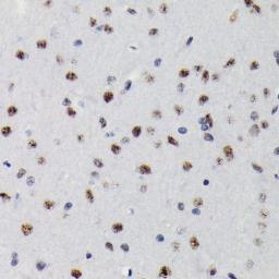 Anti-SMAD3 (phospho Ser423/Ser425) antibody [GT1207] used in IHC (Paraffin sections) (IHC-P). GTX00969