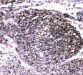 Anti-TRAF4 antibody used in IHC (Paraffin sections) (IHC-P). GTX00972