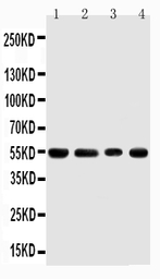 Anti-TRAF4 antibody used in Western Blot (WB). GTX00972