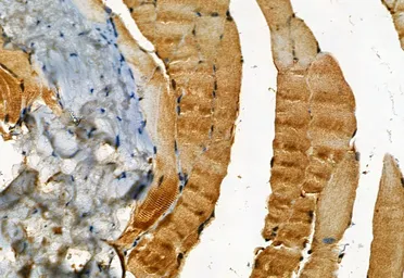Anti-MLKL (phospho Ser358) antibody used in IHC (Paraffin sections) (IHC-P). GTX00973