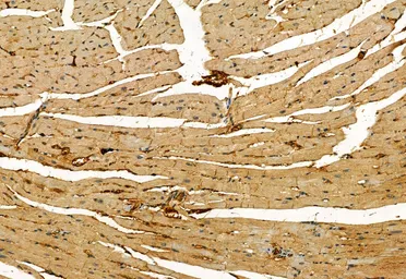 Anti-MLKL (phospho Ser358) antibody used in IHC (Paraffin sections) (IHC-P). GTX00973